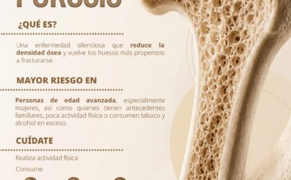 IMSS Hidalgo advierte que la osteoporosis afecta más a mujeres y se detecta tras fracturas